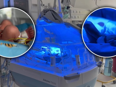 Wyjątkowa radość w szczecińskim szpitalu. Taki poród zdarza się raz na 8 tysięcy