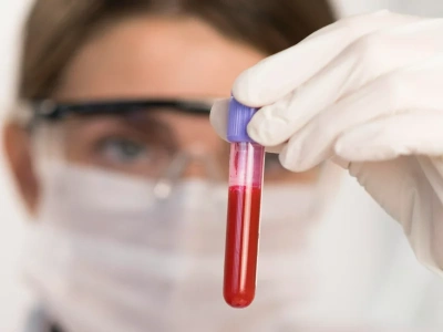 Przełom w onkologii? Nowotwór wykrywany nawet trzy lata przed diagnozą