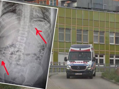 11-latek w ramach wyzwania połknął kilka petard. Matka wyjaśnia