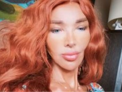 Ewa Minge o liftingu, implantach i modzie na operacje. Ostrzega przed zabiegami w Turcji
