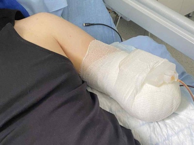 Maszyna wciągnęła i urwała mu rękę. 29-letni Piotr z Rzeszowa walczy o powrót do zdrowia