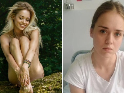„Moje ciało nie współpracuje”. Fotomodelka z Olsztyna cudem uniknęła śmierci. Angelika Kaza walczy o każdy krok i apeluje o pomoc