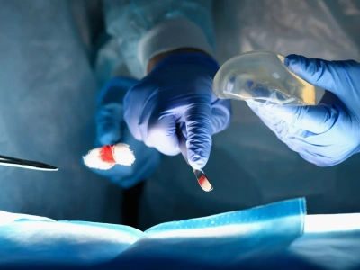 NFZ przypomina: Rekonstrukcja piersi jest bezpieczna i refundowana