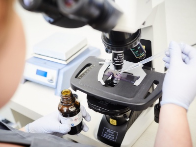 Ruchliwość plemników – dlaczego ma znaczenie przy staraniach o dziecko?