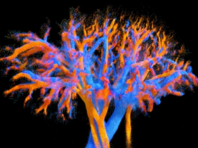 Science fiction staje się rzeczywistością: badanie ultrasonograficzne 4D pokazuje przepływ krwi w organach