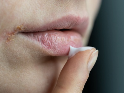 Wymieszaj w miseczce i nałóż grubą warstwę. Zapomnisz co to spierzchnięte usta