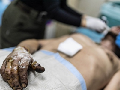 Ranny Ukrainiec czekał 33 dni. Wysłali po niego robota