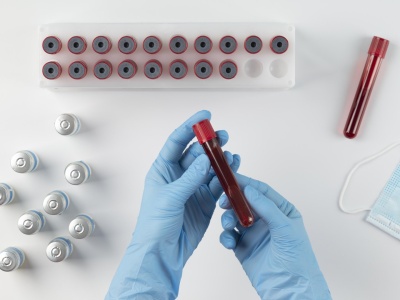 Jak odczytywać wyniki morfologii krwi? Co oznaczają poszczególne skróty?