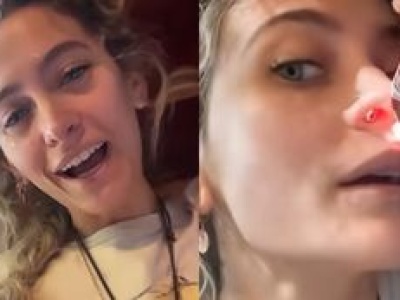 Córka Michaela Jacksona ma DZIURĘ W NOSIE przez narkotyki: 