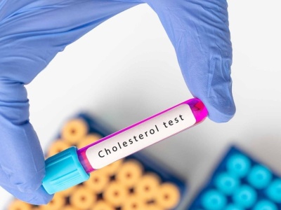 Cholesterol – to rodzinne? Zrób prosty test