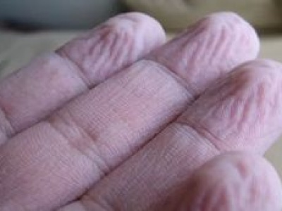 Zmarszczki na palcach po kąpieli. Co mówią o naszym zdrowiu?