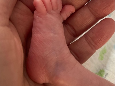 Światowy Dzień Wcześniaka: wsparcie dla najmłodszych i ich rodzin