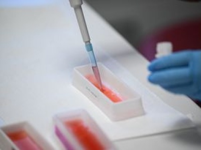 Chemiczna zagadka sprzed lat. Wreszcie została rozwiązana