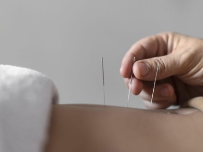 Lekarz: akupunktura nie leczy nowotworów, ale polepsza jakość życia