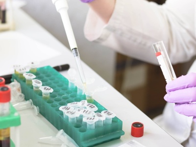 Ceny badań w górę. Wiadomo, o ile podrożeją