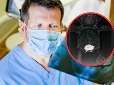 Pokazał RTG pluszowego misia swojej córki. 