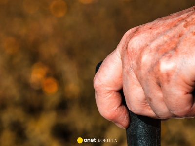 Plamki starcze po 50. roku życia. Ich przyczyna może być nieoczywista