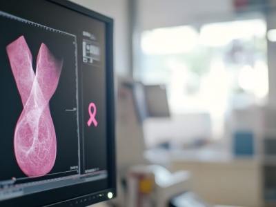 Mammobus znów w Częstochowie. W grudniu kobiety będą mogły skorzystać z bezpłatnych badań