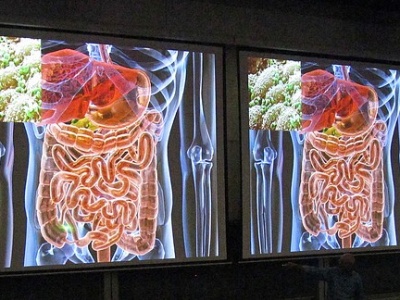 Chemikalia, z którymi na co dzień się stykamy, zaburzają pracę mikrobiomu jelit