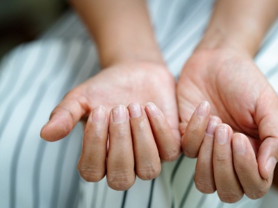 Zamiast kremem, natrzyj paznokcie pastą do zębów. Efekt cię zaskoczy