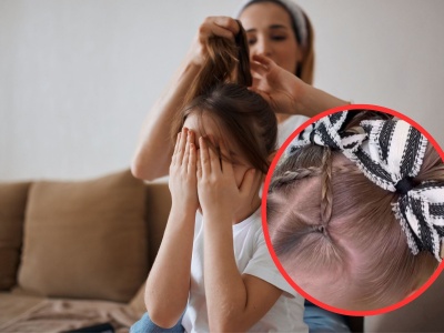 Nigdy nie czesz tak dziecka. Trycholog ostrzega. 