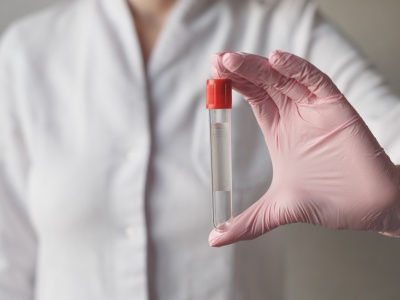 Wykrywa raka w bardzo wczesnym stadium. To nadzieja dla wielu pacjentów