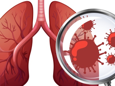 „Gruźlica jako choroba społeczna” tematem kolejnej Środy z Profilaktyką. Eksperci przekażą cenne informacje