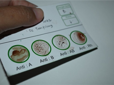 Naukowcy dotarli do najrzadszej grupy krwi. Płynie w żyłach tylko trzech osób. To może martwić