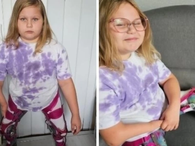 9-letnia Amelka z Borków Paduchów walczy o sprawność. Urodziła się bez kości piszczelowych – potrzebna pilna operacja za 100 tys. zł