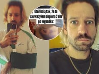Polski komik miał dramatyczny wypadek. Jeden błąd mógł kosztować go życie