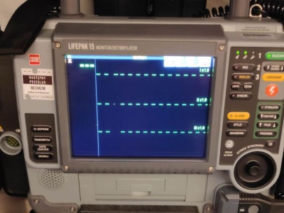 Liczyły się sekundy. Walka o życie mężczyzny na parkingu Leroy Merlin w Modlniczce