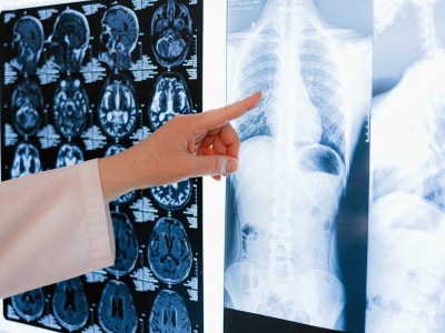 Otyłość i stan zapalny przyspieszają starzenie się płuc – nowe dane o ryzyku POChP