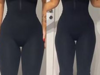 Wiele kobiet stara się je ukryć. Czym są 