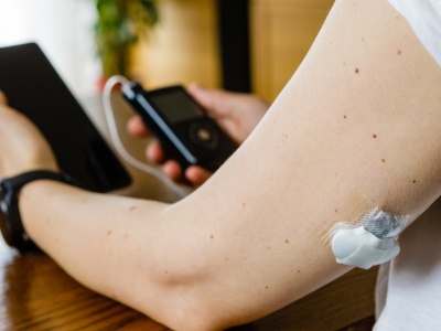 Co dalej z pompami insulinowymi po 26 roku życia? Jest mglista odpowiedź MZ