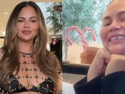Świąteczny DRAMAT Chrissy Teigen: STRACIŁA ZĘBA! Poległ w starciu ze świątecznym cukierkiem... (FOTO)