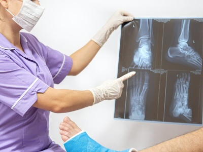 Zimą kości łamią się częściej niż myślisz. Sprawdź, co zwiększa ryzyko urazów