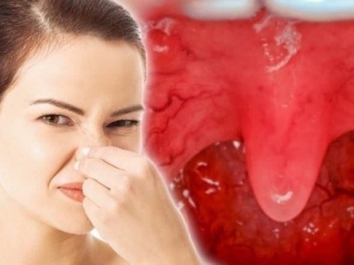 5 niesamowitych sposobów, aby powstrzymać zły oddech w 5 minut