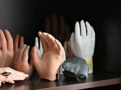 Wojna i jej ofiary. Szpital w Ammanie leczy zmasakrowane twarze i nogi po eksplozjach