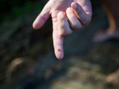 Czym jest borelioza?