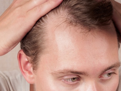 Dutasteryd — nowy surowiec w recepturze