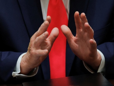 Siniaki na dłoniach Donalda Trumpa. Zdrowie prezydenta USA znów pod lupą