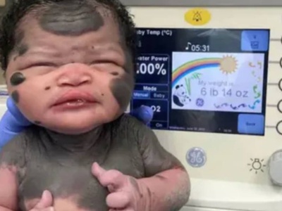 Cztery lata temu poznał ją cały świat. Tak dziś wygląda słynna 