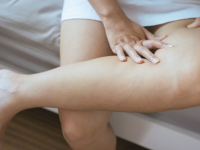 Tak unikniesz wrastających włosków po goleniu. Ważne, by zapobiec infekcji