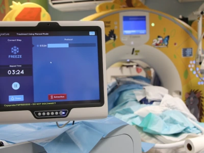 Krioablacja zmienia leczenie raka nerki. USK we Wrocławiu wykonuje 70% takich zabiegów w Polsce