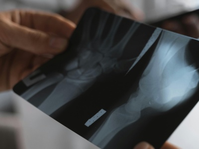 Ponad 40 tys. zł za wizytę na SOR. W tym kraju bez odpowiedniej polisy lepiej nie chorować