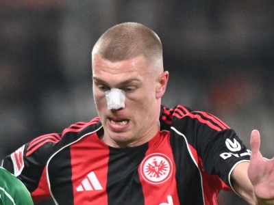 W Bundeslidze polała się krew. To musiało boleć