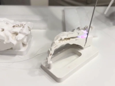 Duży sukces Robotron Surgical Technologies. Światowy gigant przejmuje ich platformę AI