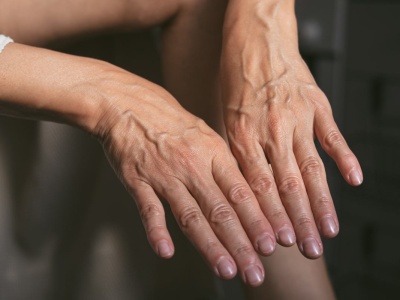 Smaruj codziennie. Dłonie będą gładkie i bez przebarwień