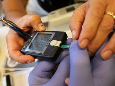 Jak obniżyć wysoki cholesterol? Lekarka zdradziła naturalny sposób