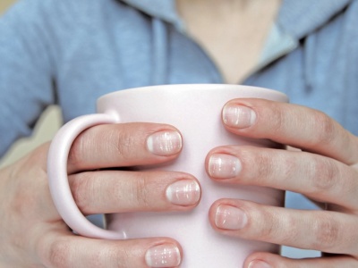 Te prążki na paznokciach to nie starość. Ciało w ten sposób woła o pomoc